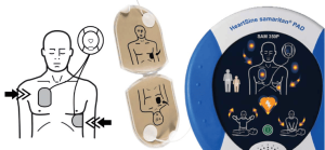 Cómo usar un desfibrilador